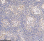 IHC analysis of SSX2IP using anti-SSX2IP antibody. SSX2IP was detected in a paraffin-embedded section of human spleen tissue. Heat mediated antigen retrieval was performed in EDTA buffer (pH 8.0, epitope retrieval solution). The tissue section was blocked with 10% goat serum. The tissue section was then incubated with 2 ug/ml rabbit anti-SSX2IP antibody overnight at 4oC. Peroxidase Conjugated Goat Anti-rabbit IgG was used as secondary antibody and incubated for 30 minutes at 37oC. The tissue section was developed using an HRP secondary and DAB substrate.