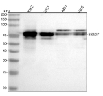 Western blot analysis of SSX2IP using anti-SSX2IP antibody. Lane 1: human K562 whole cell lysates, Lane 2: human U251 whole cell lysates, Lane 3: human whole cell lysates, Lane 4: human U20S whole cell lysates. After electrophoresis, proteins were transferred to a nitrocellulose membrane at 150 mA for 50-90 minutes. Blocked the membrane with 5% non-fat milk/TBS for 1.5 hour at RT. The membrane was incubated with rabbit anti-SSX2IP antibody at 0.5 ug/ml overnight at 4oC, then washed with TBS-0.1%Tween 3 times with 5 minutes each and probed with a goat anti-rabbit IgG-HRP secondary antibody at a dilution of 1:5000 for 1.5 hour at RT. The signal was developed using enhanced chemiluminescent. The expected band size for SSX2IP is at 71 kDa. The protein is observed as multiple species with apparent molecular weights of 70â90 kDa, corresponding to differentially phosphorylated isoforms.