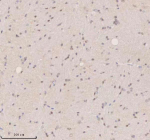 IHC analysis of SSX2IP using anti-SSX2IP antibody. SSX2IP was detected in a paraffin-embedded section of rat brain tissue. Heat mediated antigen retrieval was performed in EDTA buffer (pH 8.0, epitope retrieval solution). The tissue section was blocked with 10% goat serum. The tissue section was then incubated with 2 ug/ml rabbit anti-SSX2IP antibody overnight at 4oC. Peroxidase Conjugated Goat Anti-rabbit IgG was used as secondary antibody and incubated for 30 minutes at 37oC. The tissue section was developed using an HRP secondary and DAB substrate.
