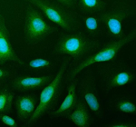 IF analysis of PHGDH using anti-PHGDH antibody (green). PHGDH was detected in an immunocytochemical section of U2OS cells. Enzyme antigen retrieval was performed using IHC enzyme antigen retrieval reagent for 15 mins. The cells were blocked with 10% goat serum. And then incubated with 5 ug/ml rabbit anti-PHGDH antibody overnight at 4oC. DyLight 488 Conjugated Goat Anti-Rabbit IgG was used as secondary antibody at 1:500 dilution and incubated for 30 minutes at 37oC. The section was counterstained with DAPI (blue). Visualize using a fluorescence microscope and filter sets appropriate for the label used.