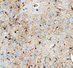 IHC analysis of PHGDH using anti-PHGDH antibody. PHGDH was detected in a paraffin-embedded section of mouse brain tissue. Heat mediated antigen retrieval was performed in EDTA buffer (pH 8.0, epitope retrieval solution). The tissue section was blocked with 10% goat serum. The tissue section was then incubated with 2 ug/ml rabbit anti-PHGDH antibody overnight at 4oC. Peroxidase Conjugated Goat Anti-rabbit IgG was used as secondary antibody and incubated for 30 minutes at 37oC. The tissue section was developed using an HRP secondary and DAB substrate.