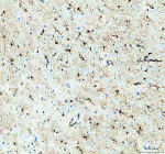 IHC analysis of PHGDH using anti-PHGDH antibody. PHGDH was detected in a paraffin-embedded section of rat brain tissue. Heat mediated antigen retrieval was performed in EDTA buffer (pH 8.0, epitope retrieval solution). The tissue section was blocked with 10% goat serum. The tissue section was then incubated with 2 ug/ml rabbit anti-PHGDH antibody overnight at 4oC. Peroxidase Conjugated Goat Anti-rabbit IgG was used as secondary antibody and incubated for 30 minutes at 37oC. The tissue section was developed using an HRP secondary and DAB substrate.