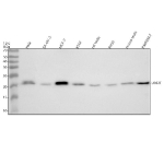 Western blot analysis of UBE2T using anti-UBE2T antibody. Electrophoresis was performed on a 12% SDS-PAGE gel at 80V (Stacking gel) / 120V (Resolving gel) for 2 hours. Lane 1: human Hela whole cell lysates, Lane 2: human SK-OV-3 whole cell lysates, Lane 3: human MCF-7 whole cell lysates, Lane 4: human K562 whole cell lysates, Lane 5: rat testis tissue lysates, Lane 6: rat RH35 whole cell lysates, Lane 7: mouse testis tissue lysates, Lane 8: mouse RAW264.7 whole cell lysates. After electrophoresis, proteins were transferred to a nitrocellulose membrane at 150 mA for 50-90 minutes. Blocked the membrane with 5% non-fat milk/TBS for 1.5 hour at RT. The membrane was incubated with rabbit anti-UBE2T antibody at 0.5 ug/ml overnight at 4oC, then washed with TBS-0.1%Tween 3 times with 5 minutes each and probed with a goat anti-rabbit IgG-HRP secondary antibody at a dilution of 1:5000 for 1.5 hour at RT. The signal was developed using an ECL Plus Western Blotting Substrate. A specific band was detected for UBE2T at approximately 23 kDa. The expected band size for UBE2T is at 23 kDa.