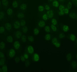 IF analysis of UBE2T using anti-UBE2T antibody (green). UBE2T was detected in an immunocytochemical section of MCF-7 cells. Enzyme antigen retrieval was performed using IHC enzyme antigen retrieval reagent for 15 mins. The cells were blocked with 10% goat serum. And then incubated with 1:100 rabbit anti-UBE2T antibody overnight at 4oC. DyLight 488 Conjugated Goat Anti-Rabbit IgG was used as secondary antibody at 1:500 dilution and incubated for 30 minutes at 37oC. Visualize using a fluorescence microscope and filter sets appropriate for the label used.