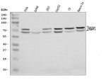 Western blot analysis of KEAP1 using anti-KEAP1 antibody. Lane 1: human Hela whole cell lysates, Lane 2: human Jurkat whole cell lysates, Lane 3: human 293T whole cell lysates, Lane 4: human HepG2 whole cell lysates, Lane 5: rat C6 whole cell lysates, Lane 6: mouse Neuro-2a whole cell lysates. After electrophoresis, proteins were transferred to a nitrocellulose membrane at 150 mA for 50-90 minutes. Blocked the membrane with 5% non-fat milk/TBS for 1.5 hour at RT. The membrane was incubated with rabbit anti-KEAP1 antibody at 0.5 ug/ml overnight at 4oC, then washed with TBS-0.1%Tween 3 times with 5 minutes each and probed with a goat anti-rabbit IgG-HRP secondary antibody at a dilution of 1:5000 for 1.5 hour at RT. The signal was developed using enhanced chemiluminescent. A specific band was detected for KEAP1 at approximately 66-72 kDa. The expected band size for KEAP1 is at 70 kDa.