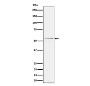 Western blot analysis of Phospho-Tau (S214) expression in mouse cerebral cortex cell lysate, using Phospho-Tau (Ser214) antibody. The expected molecular weight of phosphorylated Tau (Ser198) is approximately 45-70 kDa, corresponding to the major Tau isoforms, and lower molecular weight bands around ~35 kDa may represent truncated Tau fragments commonly observed in brain tissue.