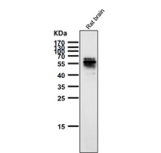 All lanes use the Phospho-Tau (Ser214) antibody at 1:1K dilution for 1 hour at room temperature. The expected molecular weight of phosphorylated Tau (Ser198) is approximately 45-70 kDa, corresponding to the major Tau isoforms, and lower molecular weight bands around ~35 kDa may represent truncated Tau fragments commonly observed in brain tissue.