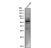 All lanes use the Phospho-Tau (Ser214) antibody at 1:1k dilution for 1 hour at room temperature. The expected molecular weight of phosphorylated Tau (Ser198) is approximately 45-70 kDa, corresponding to the major Tau isoforms, and lower molecular weight bands around ~35 kDa may represent truncated Tau fragments commonly observed in brain tissue.
