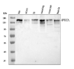 Western blot analysis of SPECC1L using anti-SPECC1L antibody. Lane 1: human Hela whole cell lysates, Lane 2: rat brain tissue lysates, Lane 3: rat C6 whole cell lysates, Lane 4: mouse lung tissue lysates, Lane 5: mouse brain tissue lysates, Lane 6: mouse Neuro-2a whole cell lysates. After electrophoresis, proteins were transferred to a nitrocellulose membrane at 150 mA for 50-90 minutes. Blocked the membrane with 5% non-fat milk/TBS for 1.5 hour at RT. The membrane was incubated with rabbit anti-SPECC1L antibody at 0.5 ug/ml overnight at 4oC, then washed with TBS-0.1%Tween 3 times with 5 minutes each and probed with a goat anti-rabbit IgG-HRP secondary antibody at a dilution of 1:5000 for 1.5 hour at RT. The signal was developed using enhanced chemiluminescent. The expected band size for SPECC1L is at 125 kDa but can be observed at 145-155 kDa, and sometimes as a doublet, consistent with its coiled-coil composition and phosphorylation.