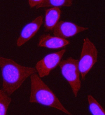 IF analysis of SPECC1L using anti-SPECC1L antibody (red). SPECC1L was detected in an immunocytochemical section of SiHa cells. Enzyme antigen retrieval was performed using IHC enzyme antigen retrieval reagent for 15 mins. The cells were blocked with 10% goat serum. And then incubated with 5 ug/ml rabbit anti-SPECC1L antibody overnight at 4oC. Cy3 Conjugated Goat Anti-Rabbit IgG was used as secondary antibody at 1:500 dilution and incubated for 30 minutes at 37oC. The section was counterstained with DAPI (blue). Visualize using a fluorescence microscope and filter sets appropriate for the label used.