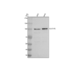 Western blot analysis of GUCY2D using anti-GUCY2D antibody. Electrophoresis was performed on a 8% SDS-PAGE gel at 80V (Stacking gel) / 120V (Resolving gel) for 2 hours. Lane 1: human 293T whole cell lysates, Lane 2: human whole cell lysates. After electrophoresis, proteins were transferred to a nitrocellulose membrane at 150 mA for 50-90 minutes. Blocked the membrane with 5% non-fat milk/TBS for 1.5 hour at RT. The membrane was incubated with rabbit anti-GUCY2D antibody at 0.5 ug/ml overnight at 4oC, then washed with TBS-0.1%Tween 3 times with 5 minutes each and probed with a goat anti-rabbit IgG-HRP secondary antibody at a dilution of 1:5000 for 1.5 hour at RT. The signal was developed using an ECL Plus Western Blotting Substrate. A specific band was detected for GUCY2D at approximately 120 kDa. The expected band size for GUCY2D is at 120 kDa.