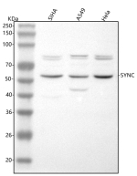 Western blot analysis of Syncoilin/SYNC using anti-SYNC antibody. Lane 1: human SiHa whole cell lysates, Lane 2: human whole cell lysates, Lane 3: human Hela whole cell lysates. After electrophoresis, proteins were transferred to a nitrocellulose membrane at 150 mA for 50-90 minutes. Blocked the membrane with 5% non-fat milk/TBS for 1.5 hour at RT. The membrane was incubated with rabbit anti-SYNC antibody at 0.5 ug/ml overnight at 4oC, then washed with TBS-0.1%Tween 3 times with 5 minutes each and probed with a goat anti-rabbit IgG-HRP secondary antibody at a dilution of 1:5000 for 1.5 hour at RT. The signal was developed using enhanced chemiluminescent. A specific band was detected for SYNC at approximately 55 kDa. The expected band size for SYNC is at 55 kDa but can also be observed at 65-70 kDa.