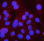 IF analysis of Syncoilin/SYNC using anti-SYNC antibody (red). SYNC was detected in an immunocytochemical section of U2OS cells. Enzyme antigen retrieval was performed using IHC enzyme antigen retrieval reagent for 15 mins. The cells were blocked with 10% goat serum. And then incubated with 5 ug/ml rabbit anti-SYNC antibody overnight at 4oC. Cy3 Conjugated Goat Anti-Rabbit IgG was used as secondary antibody at 1:500 dilution and incubated for 30 minutes at 37oC. The section was counterstained with DAPI (blue). Visualize using a fluorescence microscope and filter sets appropriate for the label used.