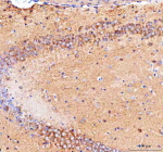 IHC analysis of CAMKK2 using anti-CAMKK2 antibody. CAMKK2 was detected in a paraffin-embedded section of mouse brain tissue. Heat mediated antigen retrieval was performed in EDTA buffer (pH 8.0, epitope retrieval solution). The tissue section was blocked with 10% goat serum. The tissue section was then incubated with 2 ug/ml rabbit anti-CAMKK2 antibody overnight at 4oC. Peroxidase Conjugated Goat Anti-rabbit IgG was used as secondary antibody and incubated for 30 minutes at 37oC. The tissue section was developed using an HRP secondary and DAB substrate.