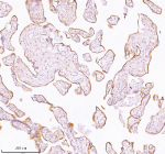 Immunohistochemical staining of TNIK using anti-TNIK antibody. TNIK was detected in a paraffin-embedded section of human placenta tissue. Heat mediated antigen retrieval was performed in EDTA buffer (pH 8.0, epitope retrieval solution). The tissue section was blocked with 10% goat serum. The tissue section was then incubated with 2 ug/ml rabbit anti-TNIK antibody overnight at 4oC. Peroxidase Conjugated Goat Anti-rabbit IgG was used as secondary antibody and incubated for 30 minutes at 37oC. The tissue section was developed using an HRP secondary and DAB substrate.