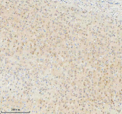 Immunohistochemical staining of TNIK using anti-TNIK antibody. TNIK was detected in a paraffin-embedded section of mouse brain tissue. Heat mediated antigen retrieval was performed in EDTA buffer (pH 8.0, epitope retrieval solution). The tissue section was blocked with 10% goat serum. The tissue section was then incubated with 2 ug/ml rabbit anti-TNIK antibody overnight at 4oC. Peroxidase Conjugated Goat Anti-rabbit IgG was used as secondary antibody and incubated for 30 minutes at 37oC. The tissue section was developed using an HRP secondary and DAB substrate.