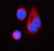 Immunofluorescent staining of FFPE human PC3 cells with TNIK antibody (red) and DAPI nuclear stain (blue). HIER: steam section in pH6 citrate buffer for 20 min.