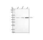 Western blot analysis of CYP4F2 using anti-CYP4F2 antibody. Lane 1: human whole cell lysates, Lane 2: human HepG2 whole cell lysates, Lane 3: human K562 whole cell lysates. After electrophoresis, proteins were transferred to a nitrocellulose membrane at 150 mA for 50-90 minutes. Blocked the membrane with 5% non-fat milk/TBS for 1.5 hour at RT. The membrane was incubated with rabbit anti-CYP4F2 antibody at 0.5 ug/ml overnight at 4oC, then washed with TBS-0.1%Tween 3 times with 5 minutes each and probed with a goat anti-rabbit IgG-HRP secondary antibody at a dilution of 1:5000 for 1.5 hour at RT. The signal was developed using enhanced chemiluminescent. The expected molecular weight of CYP4F2 is ~60 kDa (preprocessed form) and ~50 kDa (cleaved mature form).