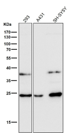 All lanes use the antibody at 1:1K dilution for 1 hour at room temperature.
