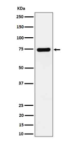 Western blot analysis of Dopamine beta Hydroxylase expression in SH-SY5Y cell lysate using DBH antibody.