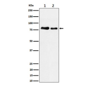 All lanes use the PKC antibody at 1:5K dilution for 1 hour at room temperature.