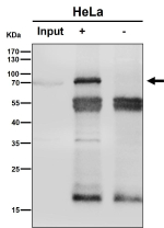 Immunoprecipitation analysis using the antibody at 1:50 dilution. (Western blot at 1:1K dilution)