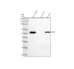 Immunoprecipitating TOM1 in HepG2 whole cell lysate. Western blot analysis of TOM1 using anti-TOM1 antibody. Lane 1: HepG2 whole cell lysates (30ug), Lane 2: Rabbit control IgG instead of anti-TOM1 antibody in HepG2 whole cell lysate, Lane 3: anti-TOM1 antibody (2ug) + HepG2 whole cell lysate (500ug). After electrophoresis, proteins were transferred to a membrane. Then the membrane was incubated with rabbit anti-TOM1 antibody at a dilution of 0.5 ug/ml and probed with a goat anti-rabbit IgG-HRP secondary antibody (Light chain). The signal is developed using ECL Plus Western Blotting Substrate. A specific band was detected for TOM1 at approximately 54 kDa. The expected band size for TOM1 is at 54 kDa.