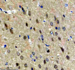 Immunohistochemical staining of NPAT using anti-NPAT antibody. NPAT was detected in a paraffin-embedded section of rat brain tissue. Heat mediated antigen retrieval was performed in EDTA buffer (pH 8.0, epitope retrieval solution). The tissue section was blocked with 10% goat serum. The tissue section was then incubated with 2 ug/ml rabbit anti-NPAT antibody overnight at 4oC. Peroxidase Conjugated Goat Anti-rabbit IgG was used as secondary antibody and incubated for 30 minutes at 37oC. The tissue section was developed using an HRP secondary and DAB substrate.