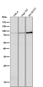 All lanes use the PRKCA/B/G antibody at 1:5K dilution for 1 hour at room temperature.