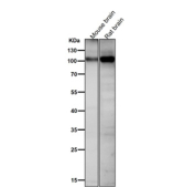 All lanes use the Phospho-AMPA Receptor 1 (Ser831) antibody at 1:1K dilution for 1 hour at room temperature.