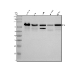 Western blot analysis of EFS using anti-EFS antibody. Electrophoresis was performed on a 10% SDS-PAGE gel at 80V (Stacking gel) / 120V (Resolving gel) for 2 hours. Lane 1: human SH-SY5Y whole cell lysates, Lane 2: human RT4 whole cell lysates, Lane 3: human SIHA whole cell lysates, Lane 4: rat ovary tissue lysates, Lane 5: rat PC-12 whole cell lysates. After electrophoresis, proteins were transferred to a nitrocellulose membrane at 150 mA for 50-90 minutes. Blocked the membrane with 5% non-fat milk/TBS for 1.5 hour at RT. The membrane was incubated with rabbit anti-EFS antibody at 0.5 ug/ml overnight at 4oC, then washed with TBS-0.1%Tween 3 times with 5 minutes each and probed with a goat anti-rabbit IgG-HRP secondary antibody at a dilution of 1:5000 for 1.5 hour at RT. The signal was developed using an ECL Plus Western Blotting Substrate. The expected band size for EFS is at 59 kDa but can be observed at 80-90 kDa due to extensive phosphorylation.