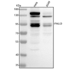 Western blot analysis of Palladin using anti-Palladin antibody. Lane 1: human Hela whole cell lysates, Lane 2: human whole cell lysates. After electrophoresis, proteins were transferred to a nitrocellulose membrane at 150 mA for 50-90 minutes. Blocked the membrane with 5% non-fat milk/TBS for 1.5 hour at RT. The membrane was incubated with rabbit anti-Palladin antibody at 0.5 ug/ml overnight at 4oC, then washed with TBS-0.1%Tween 3 times with 5 minutes each and probed with a goat anti-rabbit IgG-HRP secondary antibody at a dilution of 1:5000 for 1.5 hour at RT. The signal was developed using enhanced chemiluminescent. This protein has multiple isoforms from 65-200 kDa with doublets often observed due to distinct isoforms and phosphorylation states.