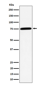 Western blot analysis of PPM1G expression in human Jurkat cell lysate using PPM1G antibody. Predicted molecular weight ~59 kDa, commonly observed at 59-75 kDa.