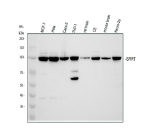 Western blot analysis of SRRT using anti-SRRT antibody. Electrophoresis was performed on a 8% SDS-PAGE gel at 80V (Stacking gel) / 120V (Resolving gel) for 2 hours. Lane 1: human MCF-7 whole cell lysates, Lane 2: human Hela whole cell lysates, Lane 3: human Caco-2 whole cell lysates, Lane 4: human THP-1 whole cell lysates, Lane 5: rat brain tissue lysates, Lane 6: rat C6 whole cell lysates, Lane 7: mouse brain tissue lysates, Lane 8: mouse Neuro-2a whole cell lysates. After electrophoresis, proteins were transferred to a nitrocellulose membrane at 150 mA for 50-90 minutes. Blocked the membrane with 5% non-fat milk/TBS for 1.5 hour at RT. The membrane was incubated with rabbit anti-SRRT antibody at 0.5 ug/ml overnight at 4oC, then washed with TBS-0.1%Tween 3 times with 5 minutes each and probed with a goat anti-rabbit IgG-HRP secondary antibody at a dilution of 1:5000 for 1.5 hour at RT. The signal is developed using an ECL Plus Western Blotting Substratewith Tanon 5200 system. A specific band was detected for SRRT at approximately 101 kDa. The expected band size for SRRT is at 101 kDa.