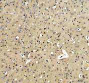 Immunohistochemical staining of SRRT using anti-SRRT antibody. SRRT was detected in a paraffin-embedded section of mouse brain tissue. Heat mediated antigen retrieval was performed in EDTA buffer (pH 8.0, epitope retrieval solution). The tissue section was blocked with 10% goat serum. The tissue section was then incubated with 2 ug/ml rabbit anti-SRRT antibody overnight at 4oC. Peroxidase Conjugated Goat Anti-rabbit IgG was used as secondary antibody and incubated for 30 minutes at 37oC. The tissue section was developed using an HRP secondary and DAB substrate.