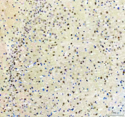 Immunohistochemical staining of SRRT using anti-SRRT antibody. SRRT was detected in a paraffin-embedded section of rat brain tissue. Heat mediated antigen retrieval was performed in EDTA buffer (pH 8.0, epitope retrieval solution). The tissue section was blocked with 10% goat serum. The tissue section was then incubated with 2 ug/ml rabbit anti-SRRT antibody overnight at 4oC. Peroxidase Conjugated Goat Anti-rabbit IgG was used as secondary antibody and incubated for 30 minutes at 37oC. The tissue section was developed using an HRP secondary and DAB substrate.