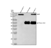 Immunoprecipitation of SRRT protein from 500ug of human MCF7 whole cell lysate with 2ug of SRRT antibody.