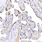 Immunohistochemical staining of SRRT using anti-SRRT antibody. SRRT was detected in a paraffin-embedded section of human placenta tissue. Heat mediated antigen retrieval was performed in EDTA buffer (pH 8.0, epitope retrieval solution). The tissue section was blocked with 10% goat serum. The tissue section was then incubated with 2 ug/ml rabbit anti-SRRT antibody overnight at 4oC. Peroxidase Conjugated Goat Anti-rabbit IgG was used as secondary antibody and incubated for 30 minutes at 37oC. The tissue section was developed using an HRP secondary and DAB substrate.