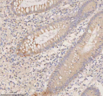 Immunohistochemical staining of RIGI using anti-RIGI antibody. RIGI was detected in a paraffin-embedded section of human appendicitis tissue. Heat mediated antigen retrieval was performed in EDTA buffer (pH 8.0, epitope retrieval solution). The tissue section was blocked with 10% goat serum. The tissue section was then incubated with 2 ug/ml rabbit anti-RIGI antibody overnight at 4oC. Peroxidase Conjugated Goat Anti-rabbit IgG was used as secondary antibody and incubated for 30 minutes at 37oC. The tissue section was developed using an HRP secondary and DAB substrate.