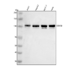 Western blot analysis of RIGI using anti-RIGI antibody. Lane 1: human whole cell lysates, Lane 2: human HepG2 whole cell lysates, Lane 3: human MCF-7 whole cell lysates, Lane 4: human Hela whole cell lysates. After electrophoresis, proteins were transferred to a nitrocellulose membrane at 150 mA for 50-90 minutes. Blocked the membrane with 5% non-fat milk/TBS for 1.5 hour at RT. The membrane was incubated with rabbit anti-RIGI antibody at 0.5 ug/ml overnight at 4oC, then washed with TBS-0.1%Tween 3 times with 5 minutes each and probed with a goat anti-rabbit IgG-HRP secondary antibody at a dilution of 1:5000 for 1.5 hour at RT. The signal was developed using enhanced chemiluminescent. The expected band size for RIGI is at 107 kDa.