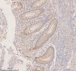 Immunohistochemical staining of RIGI using anti-RIGI antibody. RIGI was detected in a paraffin-embedded section of human appendicitis tissue. Heat mediated antigen retrieval was performed in EDTA buffer (pH 8.0, epitope retrieval solution). The tissue section was blocked with 10% goat serum. The tissue section was then incubated with 2 ug/ml rabbit anti-RIGI antibody overnight at 4oC. Peroxidase Conjugated Goat Anti-rabbit IgG was used as secondary antibody and incubated for 30 minutes at 37oC. The tissue section was developed using an HRP secondary and DAB substrate.