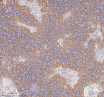 Immunohistochemical staining of RIGI using anti-RIGI antibody. RIGI was detected in a paraffin-embedded section of human spleen tissue. Heat mediated antigen retrieval was performed in EDTA buffer (pH 8.0, epitope retrieval solution). The tissue section was blocked with 10% goat serum. The tissue section was then incubated with 2 ug/ml rabbit anti-RIGI antibody overnight at 4oC. Peroxidase Conjugated Goat Anti-rabbit IgG was used as secondary antibody and incubated for 30 minutes at 37oC. The tissue section was developed using an HRP secondary and DAB substrate.