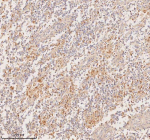 Immunohistochemical staining of RIGI using anti-RIGI antibody. RIGI was detected in a paraffin-embedded section of human testicular seminoma tissue. Heat mediated antigen retrieval was performed in EDTA buffer (pH 8.0, epitope retrieval solution). The tissue section was blocked with 10% goat serum. The tissue section was then incubated with 2 ug/ml rabbit anti-RIGI antibody overnight at 4oC. Peroxidase Conjugated Goat Anti-rabbit IgG was used as secondary antibody and incubated for 30 minutes at 37oC. The tissue section was developed using an HRP secondary and DAB substrate.