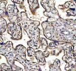 Immunohistochemical staining of TNS4 using anti-TNS4 antibody. TNS4 was detected in a paraffin-embedded section of human placenta tissue. Heat mediated antigen retrieval was performed in EDTA buffer (pH 8.0, epitope retrieval solution). The tissue section was blocked with 10% goat serum. The tissue section was then incubated with 2 ug/ml rabbit anti-TNS4 antibody overnight at 4oC. Peroxidase Conjugated Goat Anti-rabbit IgG was used as secondary antibody and incubated for 30 minutes at 37oC. The tissue section was developed using an HRP secondary and DAB substrate.
