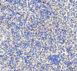 Immunohistochemical staining of FAM50A using anti-FAM50A antibody. FAM50A was detected in a paraffin-embedded section of human spleen tissue. Heat mediated antigen retrieval was performed in EDTA buffer (pH 8.0, epitope retrieval solution). The tissue section was blocked with 10% goat serum. The tissue section was then incubated with 1:50 rabbit anti-FAM50A antibody overnight at 4oC. Peroxidase Conjugated Goat Anti-rabbit IgG was used as secondary antibody and incubated for 30 minutes at 37oC. The tissue section was developed using an HRP secondary and DAB substrate.