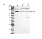 Western blot analysis of FAM111B using anti-FAM111B antibody. Lane 1: human PC-3 whole cell lysates, Lane 2: human Hela whole cell lysates, Lane 3: human MCF-7 whole cell lysates. After electrophoresis, proteins were transferred to a nitrocellulose membrane at 150 mA for 50-90 minutes. Blocked the membrane with 5% non-fat milk/TBS for 1.5 hour at RT. The membrane was incubated with rabbit anti-FAM111B antibody at 0.5 ug/ml overnight at 4oC, then washed with TBS-0.1%Tween 3 times with 5 minutes each and probed with a goat anti-rabbit IgG-HRP secondary antibody at a dilution of 1:5000 for 1.5 hour at RT. The signal was developed using enhanced chemiluminescent. A specific band was detected for FAM111B at approximately 85 kDa. The expected band size for FAM111B is at 85 kDa.