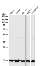 All lanes use the Histone H3 (tri methyl K27) antibody at 1:1K dilution for 1 hour at room temperature.