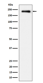Western blot analysis of Phospho-EGFR (Y869) expression in treated with EGF cell lysate using Phospho-EGFR (Tyr845) antibody.