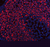 Immunofluorescent staining of ATP4B using anti-ATP4B antibody (red). ATP4B was detected in a paraffin-embedded section of rat stomach tissue. Heat mediated antigen retrieval was performed in EDTA buffer (pH 8.0, epitope retrieval solution). The tissue section was blocked with 10% goat serum. The tissue section was then incubated with 5 ug/ml rabbit anti-ATP4B antibody overnight at 4oC. DyLight 594 Conjugated Goat Anti-Rabbit IgG was used as secondary antibody at 1:500 dilution and incubated for 30 minutes at 37oC. The section was counterstained with DAPI nuclear stain (blue). Visualize using a fluorescence microscope and filter sets appropriate for the label used.