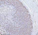 Immunohistochemical staining of ATP4B using anti-ATP4B antibody. ATP4B was detected in a paraffin-embedded section of rat stomach tissue. Heat mediated antigen retrieval was performed in EDTA buffer (pH 8.0, epitope retrieval solution). The tissue section was blocked with 10% goat serum. The tissue section was then incubated with 2 ug/ml rabbit anti-ATP4B antibody overnight at 4oC. Peroxidase Conjugated Goat Anti-rabbit IgG was used as secondary antibody and incubated for 30 minutes at 37oC. The tissue section was developed using an HRP secondary and DAB substrate.
